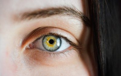 What is Dry Eye Syndrome?